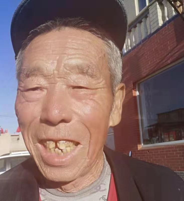 走失者照片 锦州市寻人：八旬老人走失，患小脑萎...
