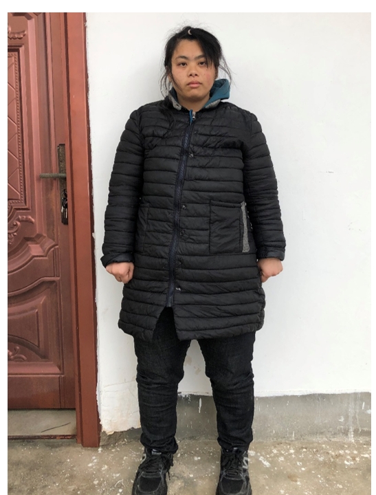 走失者照片 赣州市寻亲：青年女子被救助，穿黑色...