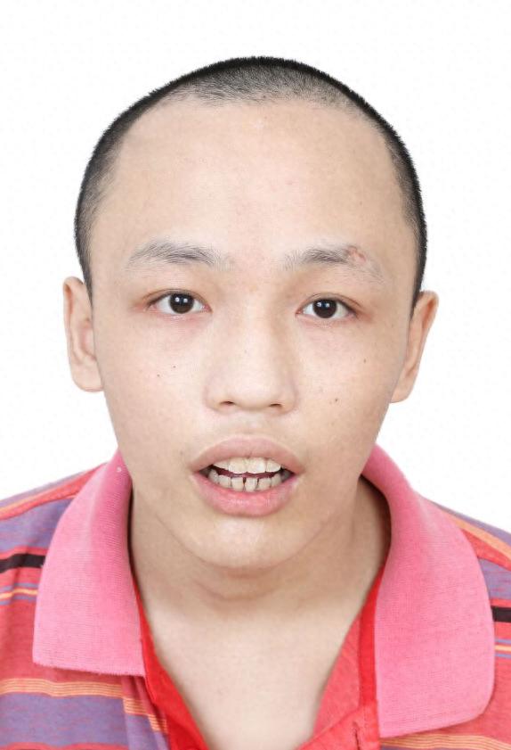 走失者照片 佛山市寻亲：青年男子被救助，高1米...