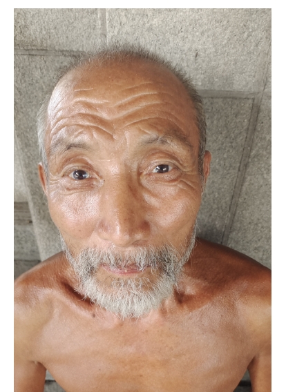 走失者照片 株洲市寻亲：七旬老人被救助，自述叫...
