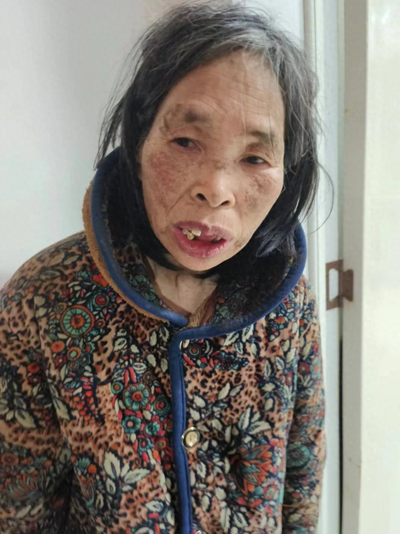 走失者照片 阜阳市寻亲：六旬老太被救助，穿碎花...