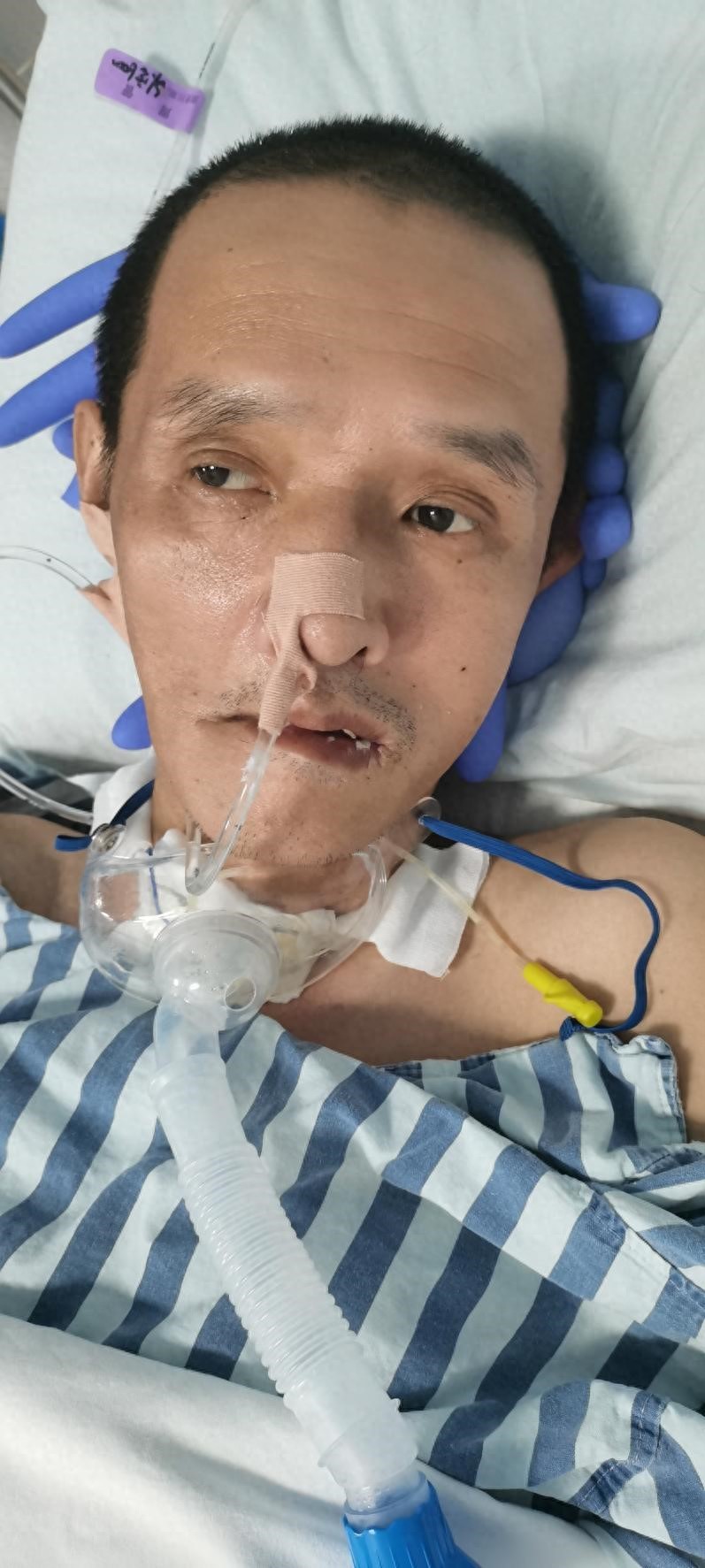 走失者照片 患者寻亲：五旬男子在惠州市被救助，...