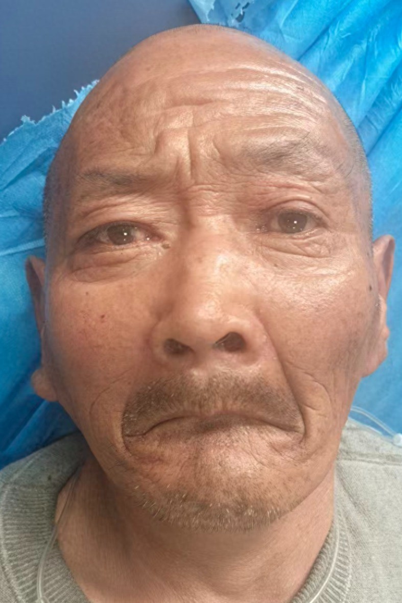 走失者照片 宝鸡市寻亲：五旬男子被救助，自述叫...