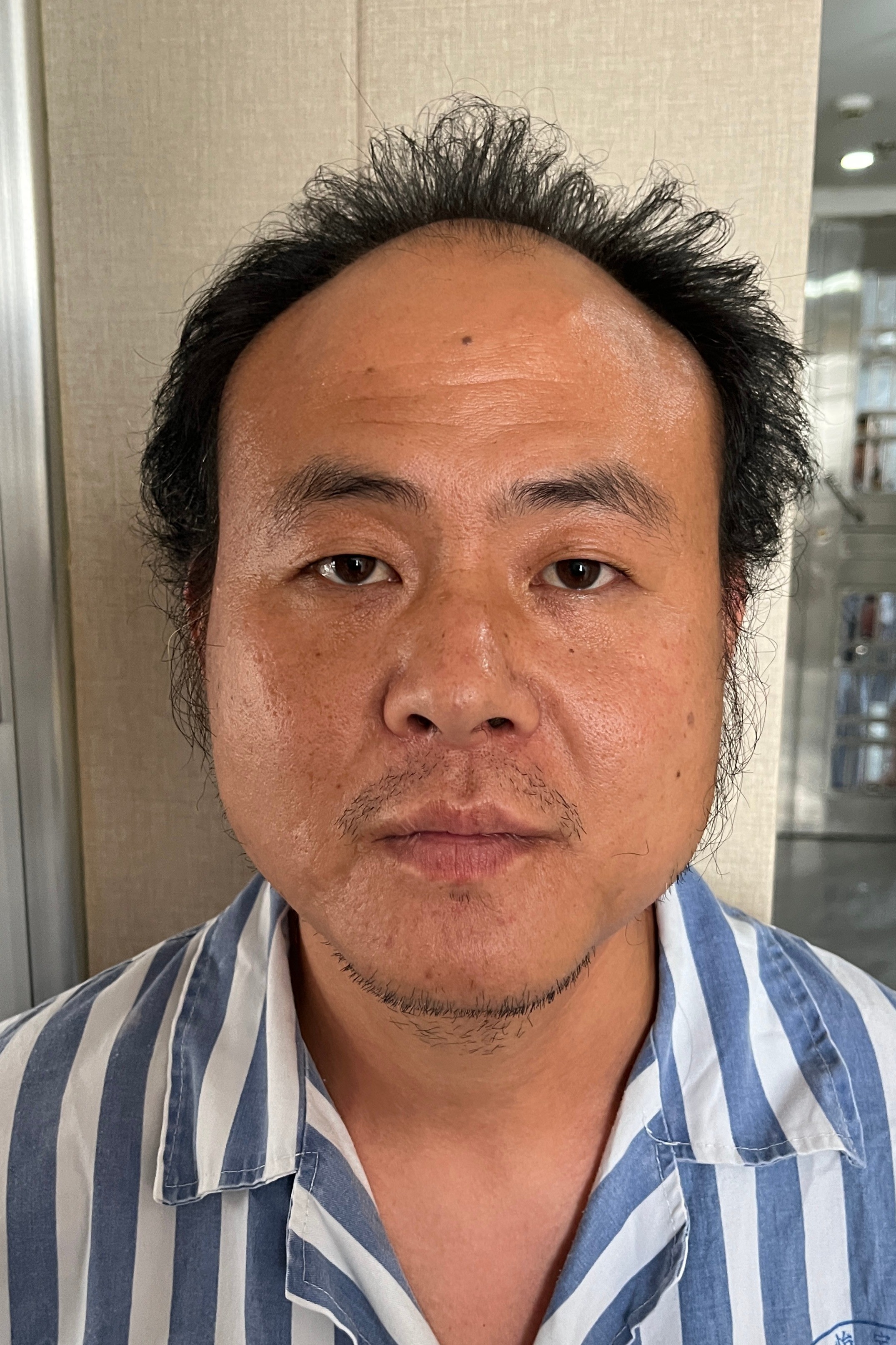 走失者照片 海口市寻亲：青年男子被救助，自述叫...