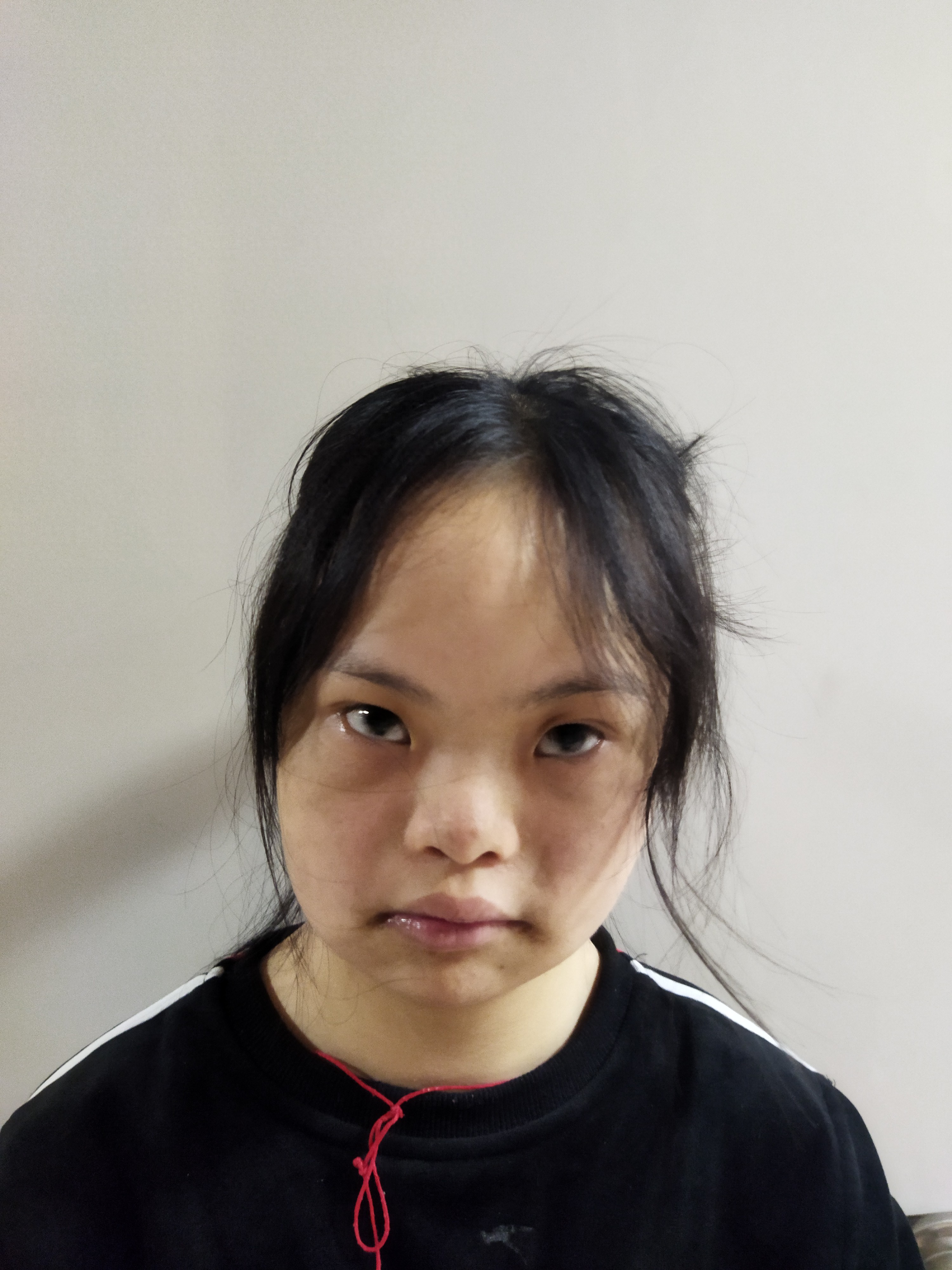 走失者照片 惠州市寻亲：青年女子被救助，自述叫...