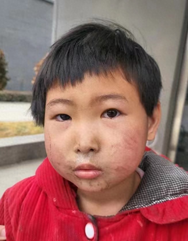 走失者照片 濮阳市寻亲：6岁女孩被救助，穿红色...