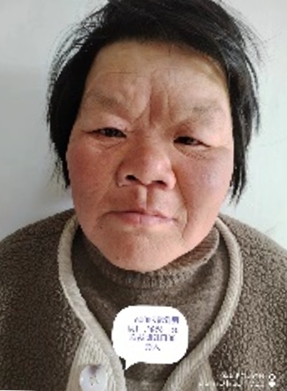 走失者照片 周口市项城市寻亲：中年女子被救助，...