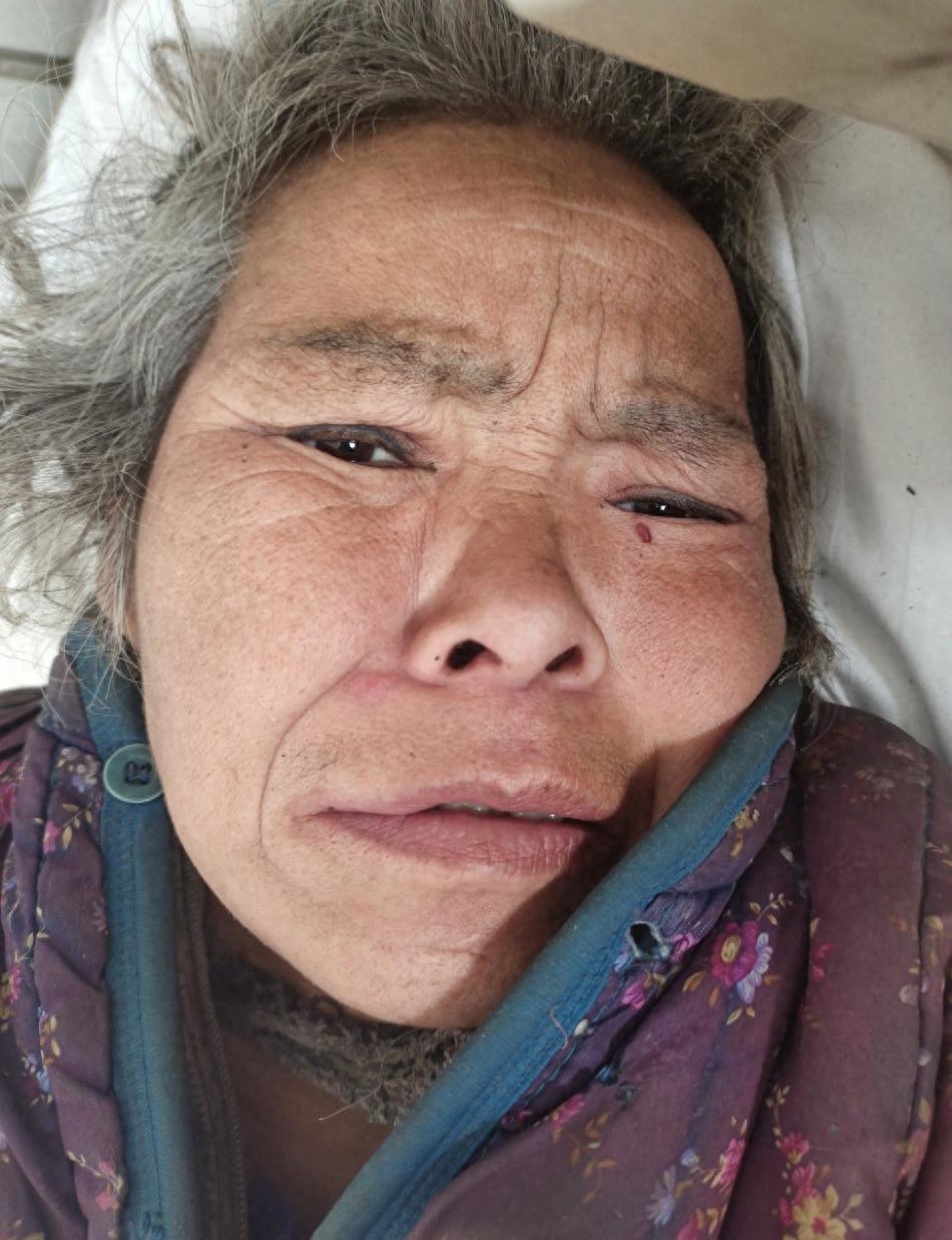 走失者照片 商丘市永城市寻亲：六旬老太被救助，...