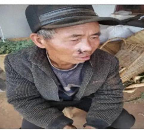 走失者照片 曲靖市寻人：六旬老人走失，穿黑色毛...
