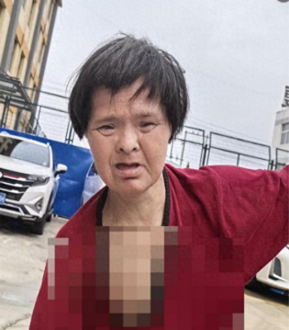 走失者照片 菏泽市寻亲：五旬女子被救助，高1米...