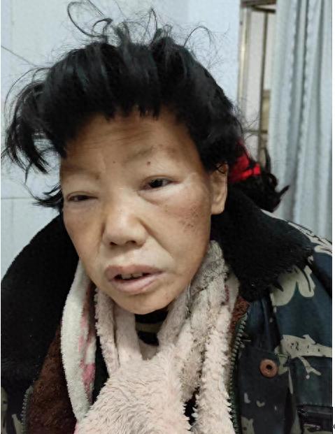 走失者照片 许昌市寻亲：五旬女子被救助，高1米...