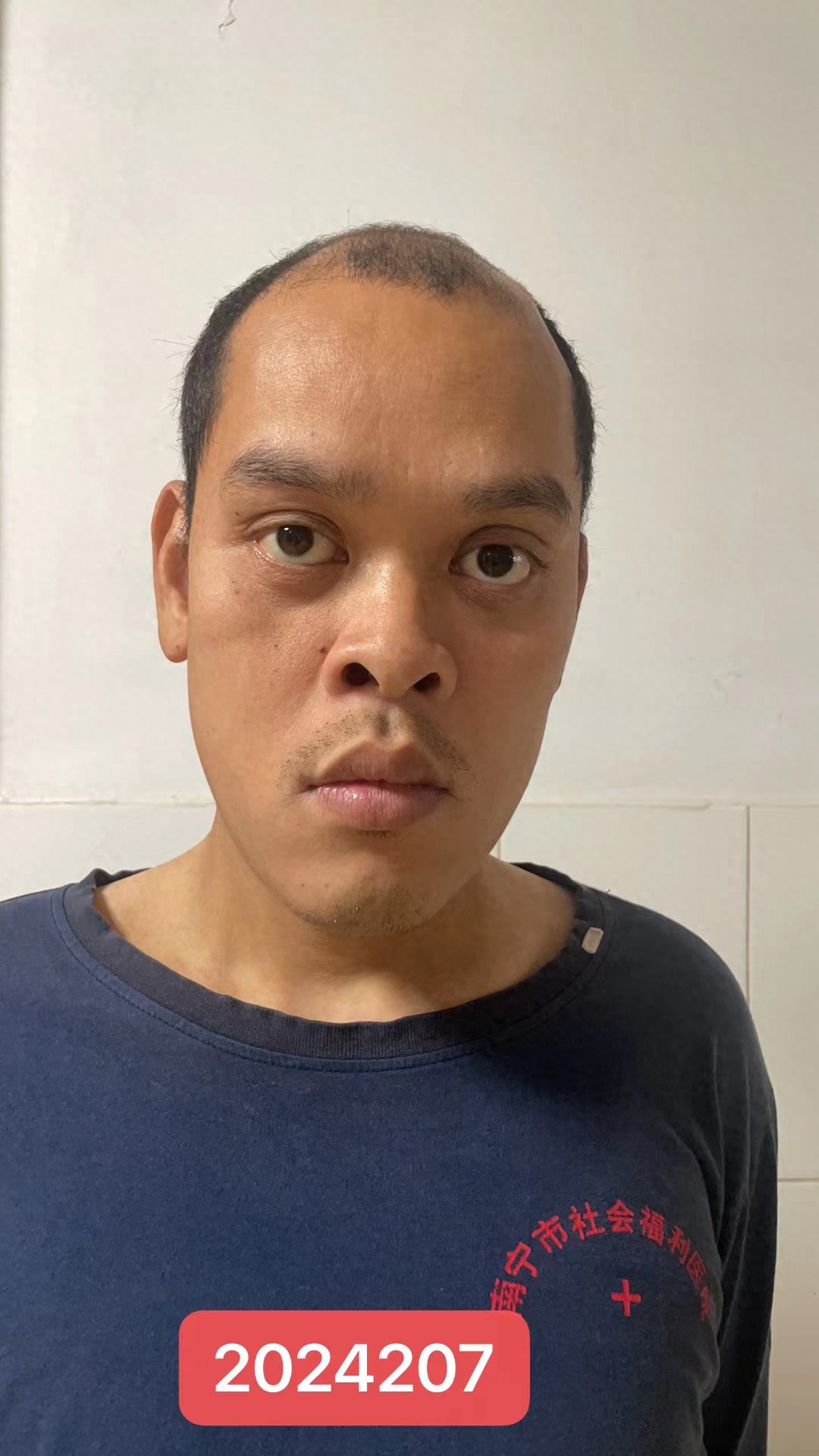走失者照片 南宁市寻亲：中年男子被救助，高1米...