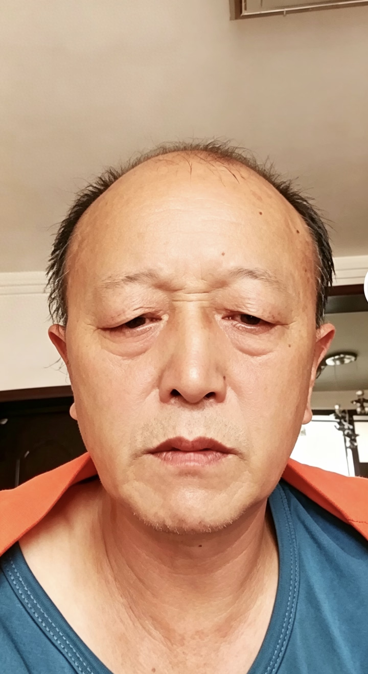 走失者照片 安康市寻人：六旬老人走失，患脑梗，...