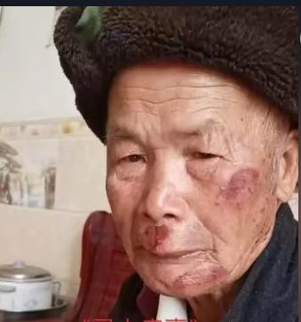 走失者照片 贵港市寻人：八旬老人走失，穿黑色上...