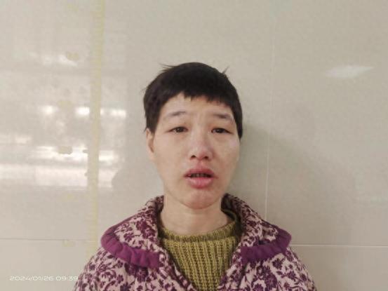 走失者照片 桂林市寻亲：青年女子被救助，穿军绿...