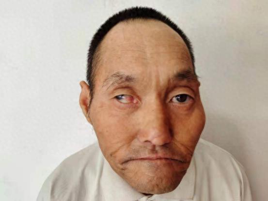 走失者照片 乌鲁木齐市寻亲：五旬男子被救助，穿...
