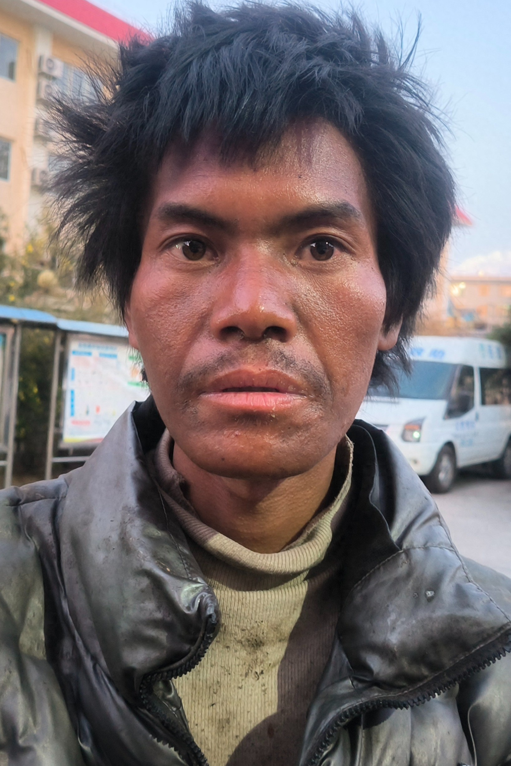 走失者照片 昭通市寻亲：青年男子被救助，高1米...