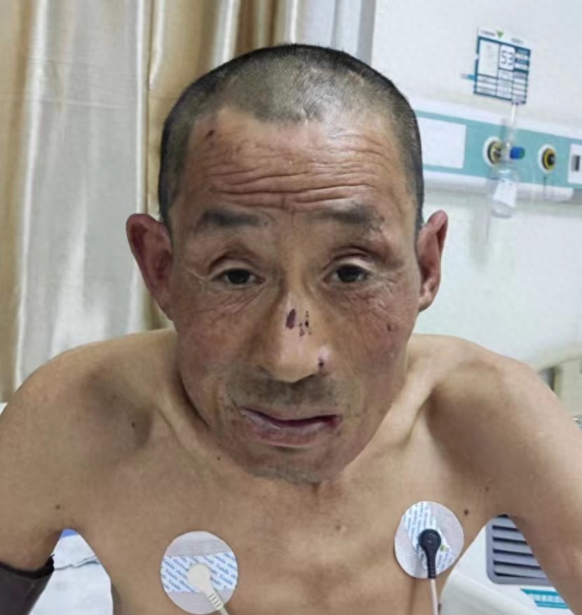 走失者照片 濮阳市寻亲：五旬男子被救助，穿米黄...