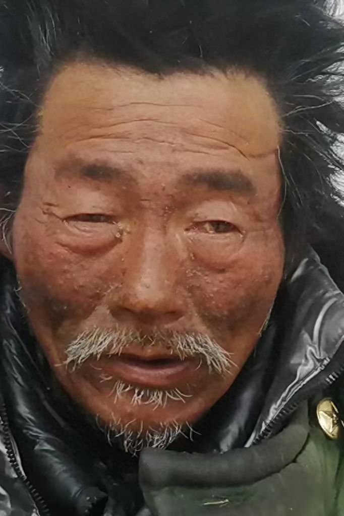 走失者照片 宿州市寻亲：五旬男子被救助，自述叫...