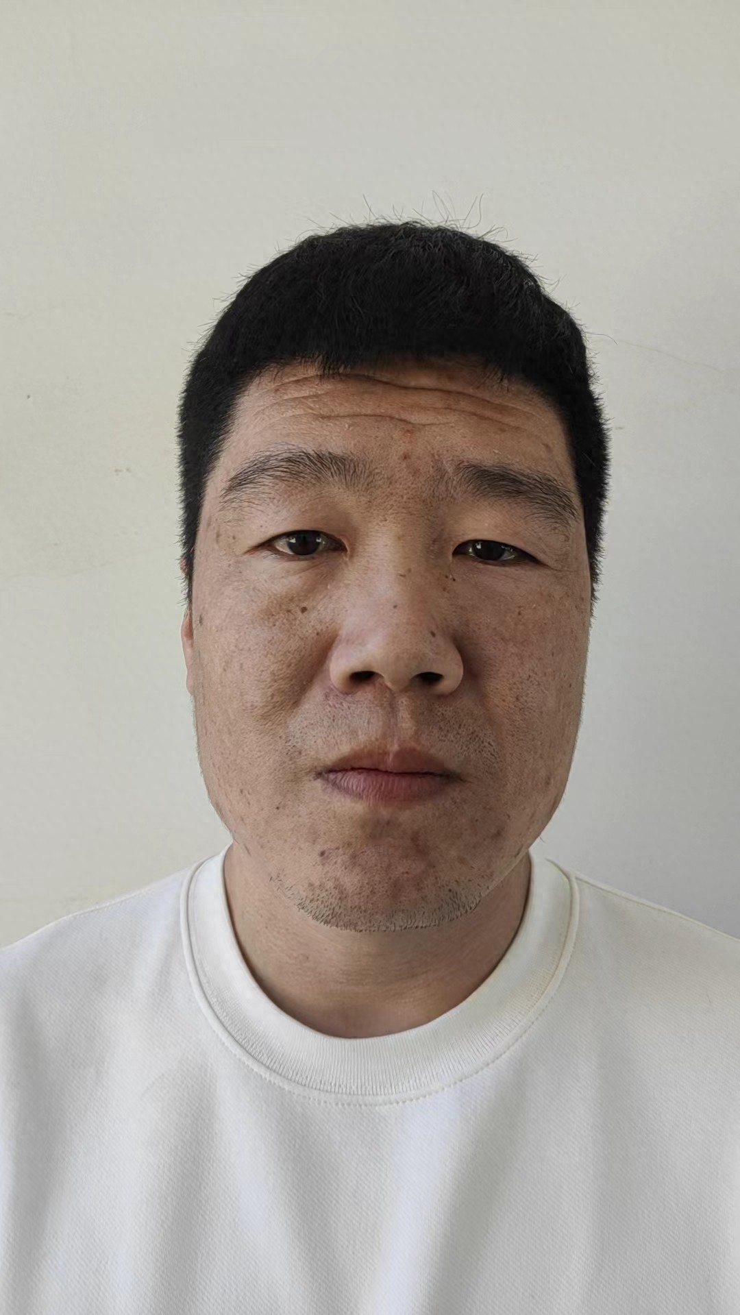 走失者照片 保定市高碑店市寻亲：青年男子被救助...