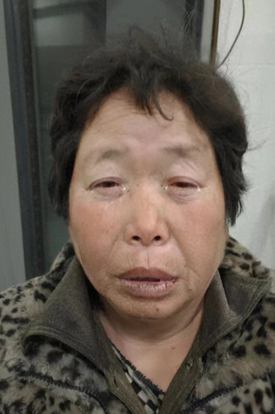 走失者照片 亳州市寻亲：中年女子被救助，穿虎皮...