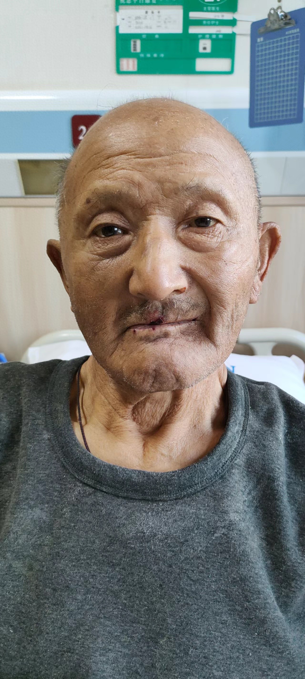 走失者照片 保定市寻亲：八旬老人被救助，自述叫...