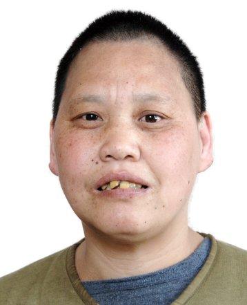 走失者照片 济南市寻亲：中年女子被救助多年，高...