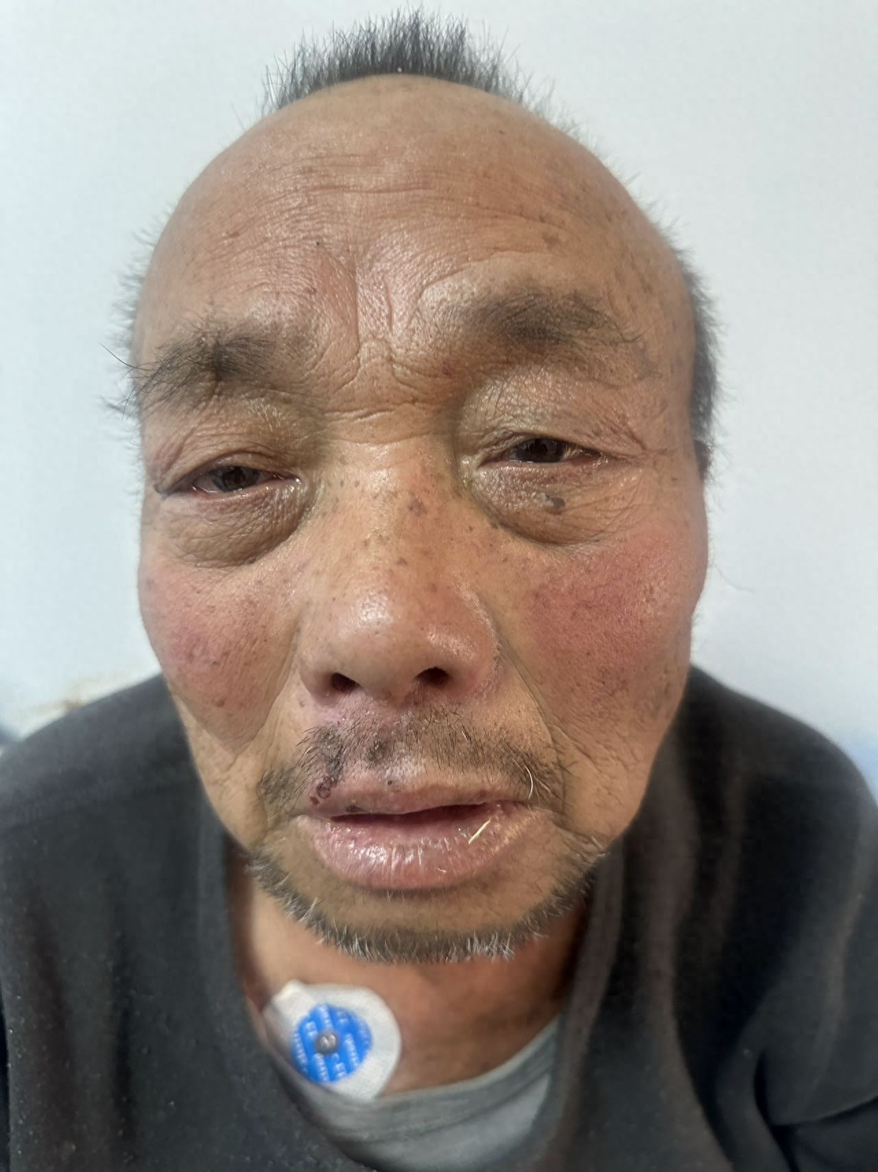 走失者照片 阿克苏地区阿克苏市寻亲：六旬老人被...