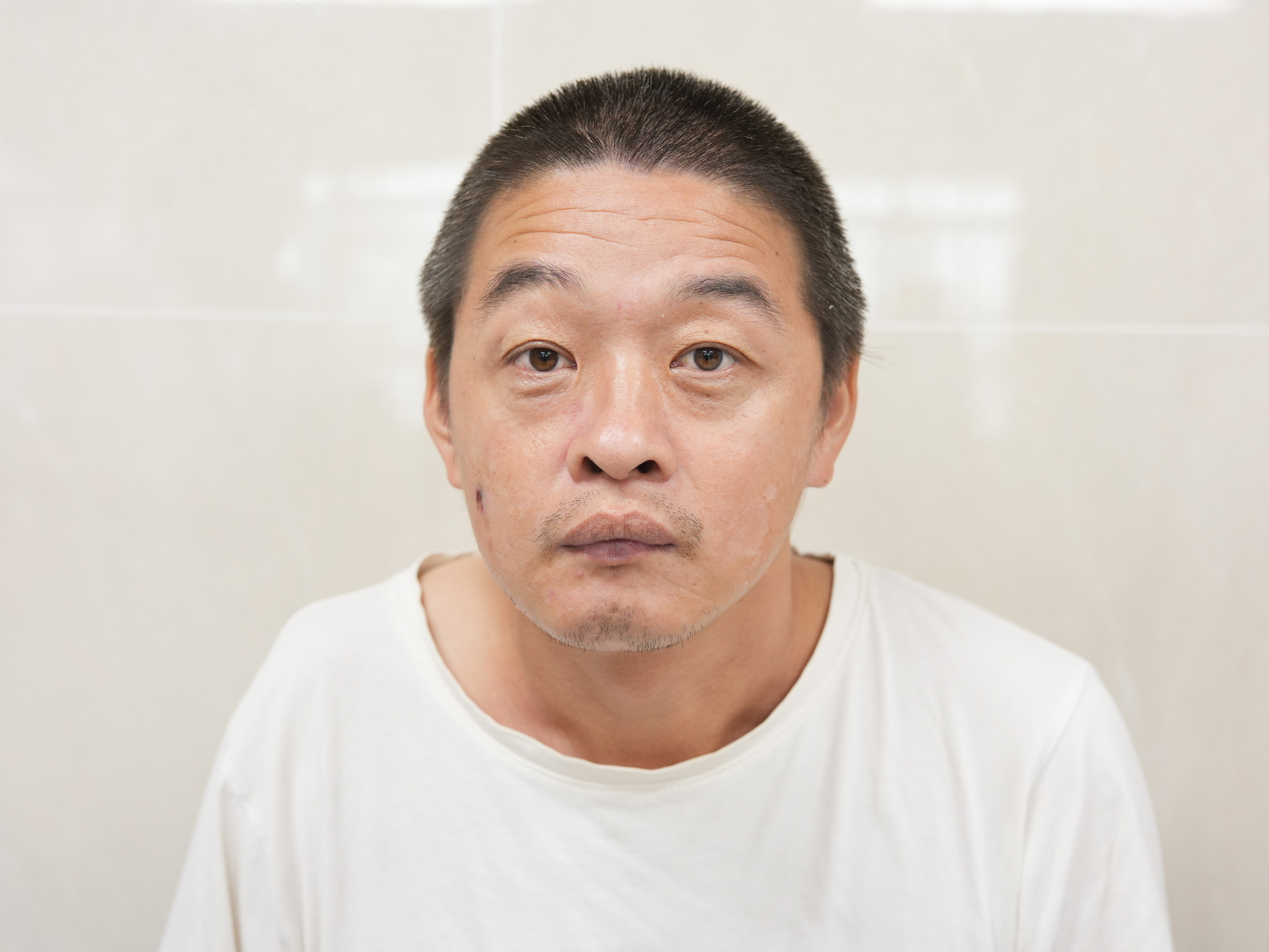 走失者照片 厦门市寻亲：中年男子被救助，疑似湖...