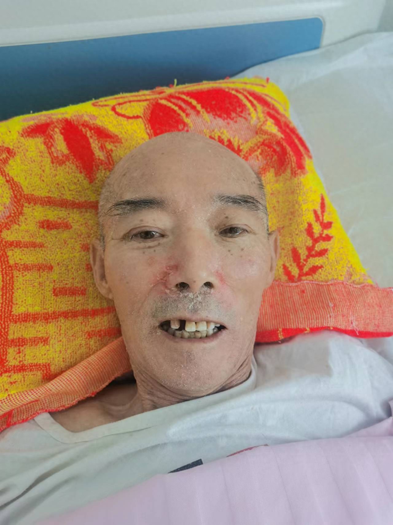 走失者照片 呼伦贝尔市寻亲：七旬老人被救助，自...