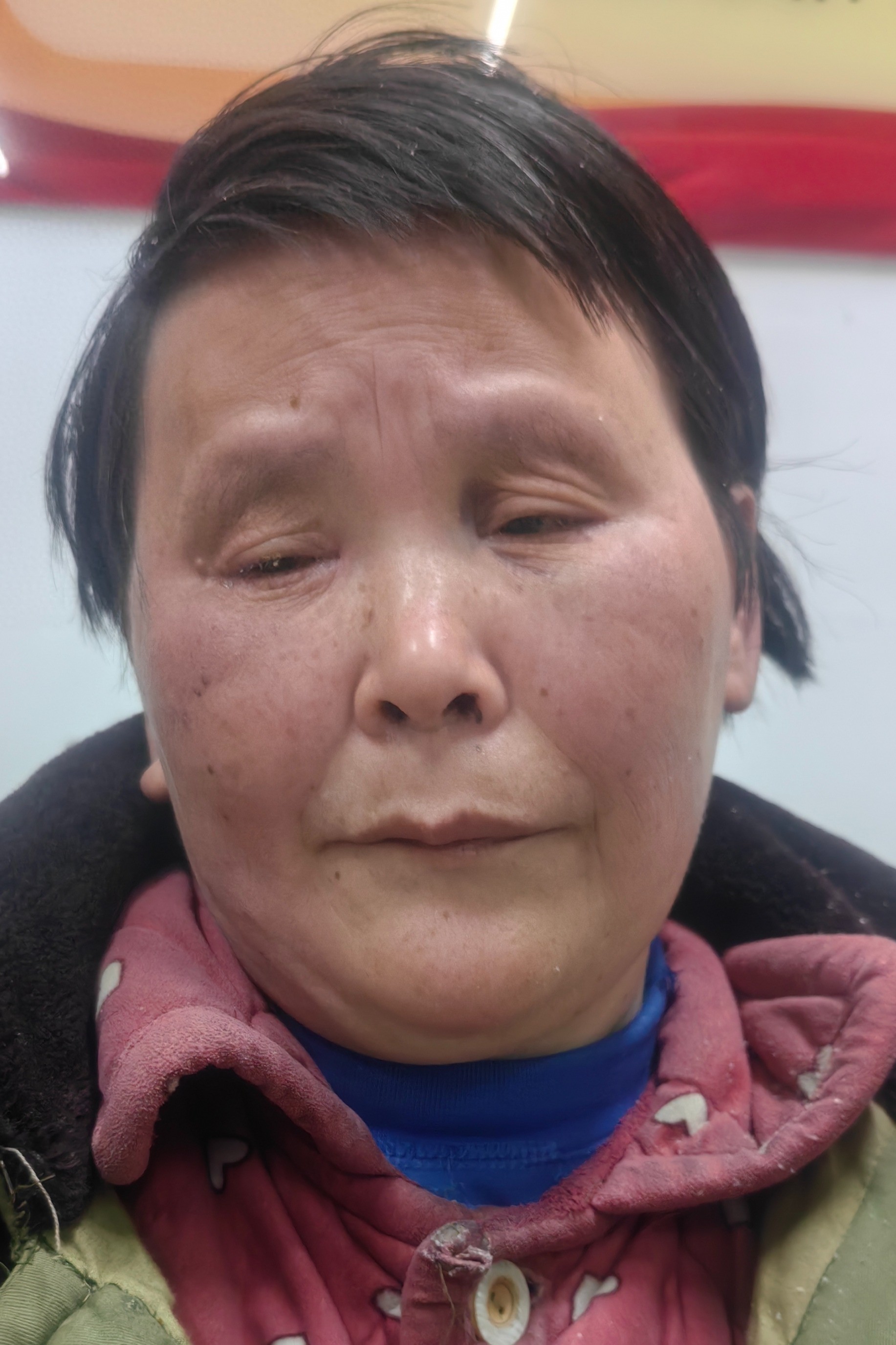 走失者照片 宿州市寻亲：六旬老太被救助，高1米...
