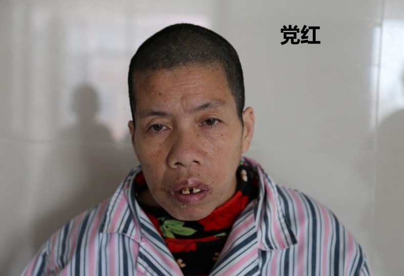 走失者照片 菏泽市寻亲：五旬女子被救助，高1米...