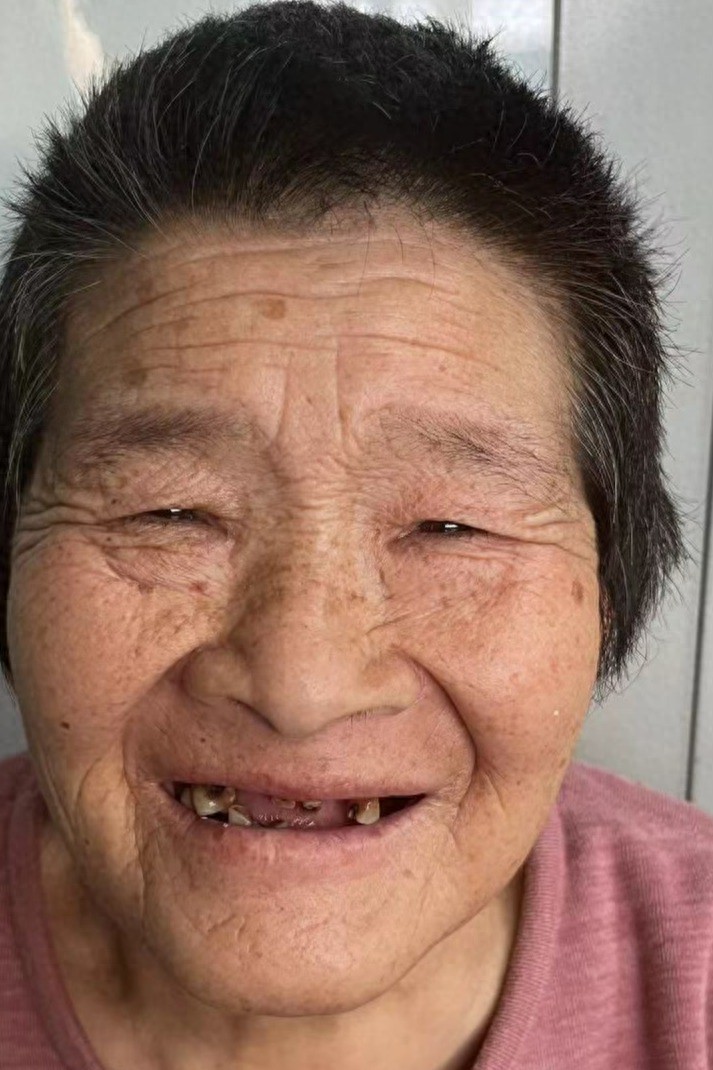 走失者照片 秦皇岛市寻亲：七旬老太被救助，穿粉...