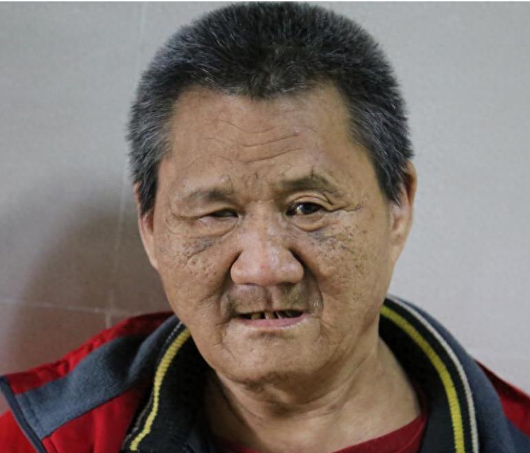 走失者照片 菏泽市寻亲：五旬男子被救助，疑似精...