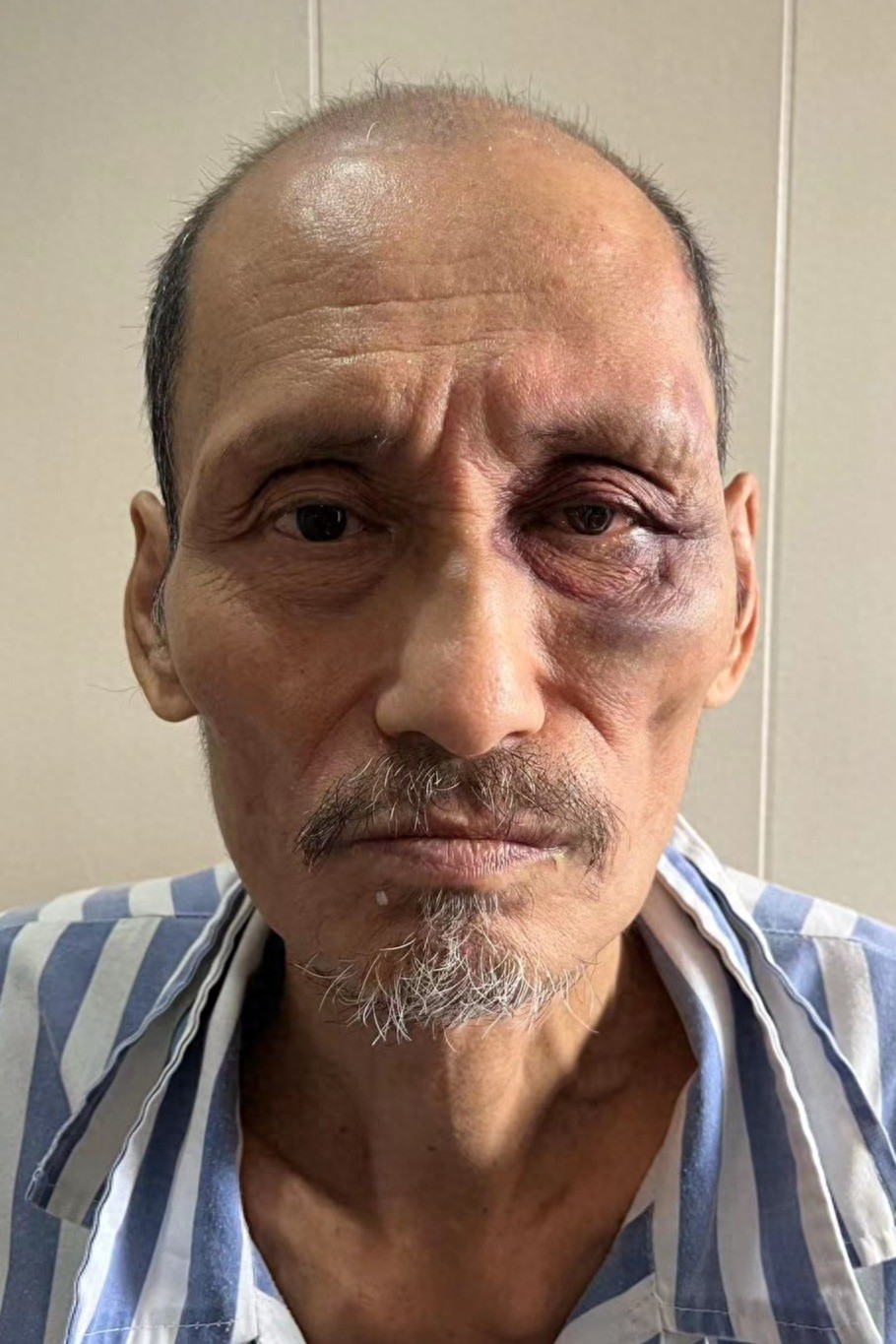 走失者照片 海口市寻亲：六旬老人被救助，自述叫...
