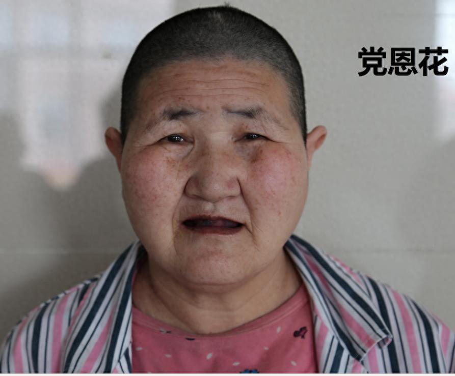 走失者照片 菏泽市寻亲：五旬女子被救助，疑似精...