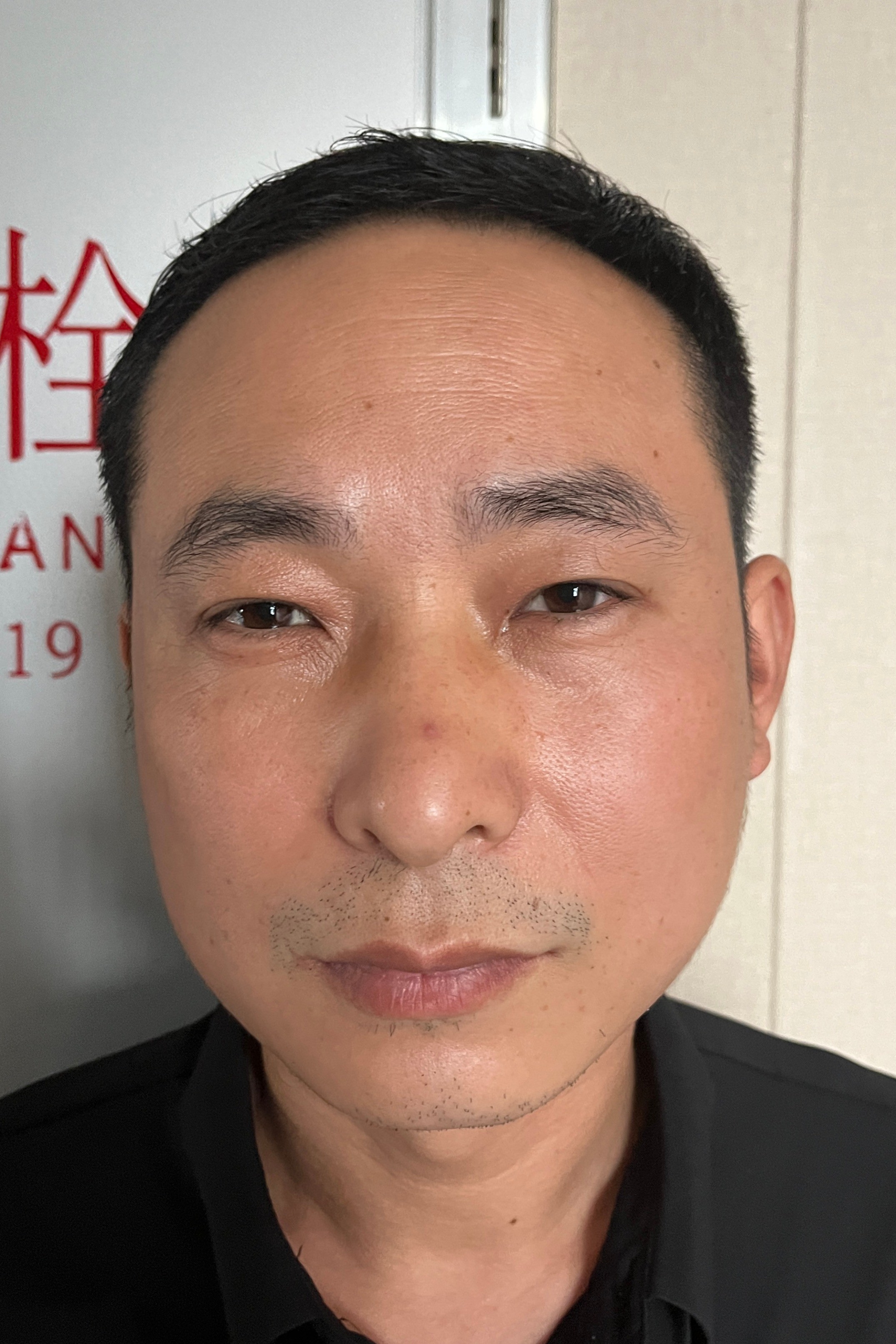 走失者照片 海口市寻亲：青年男子被救助，自述叫...