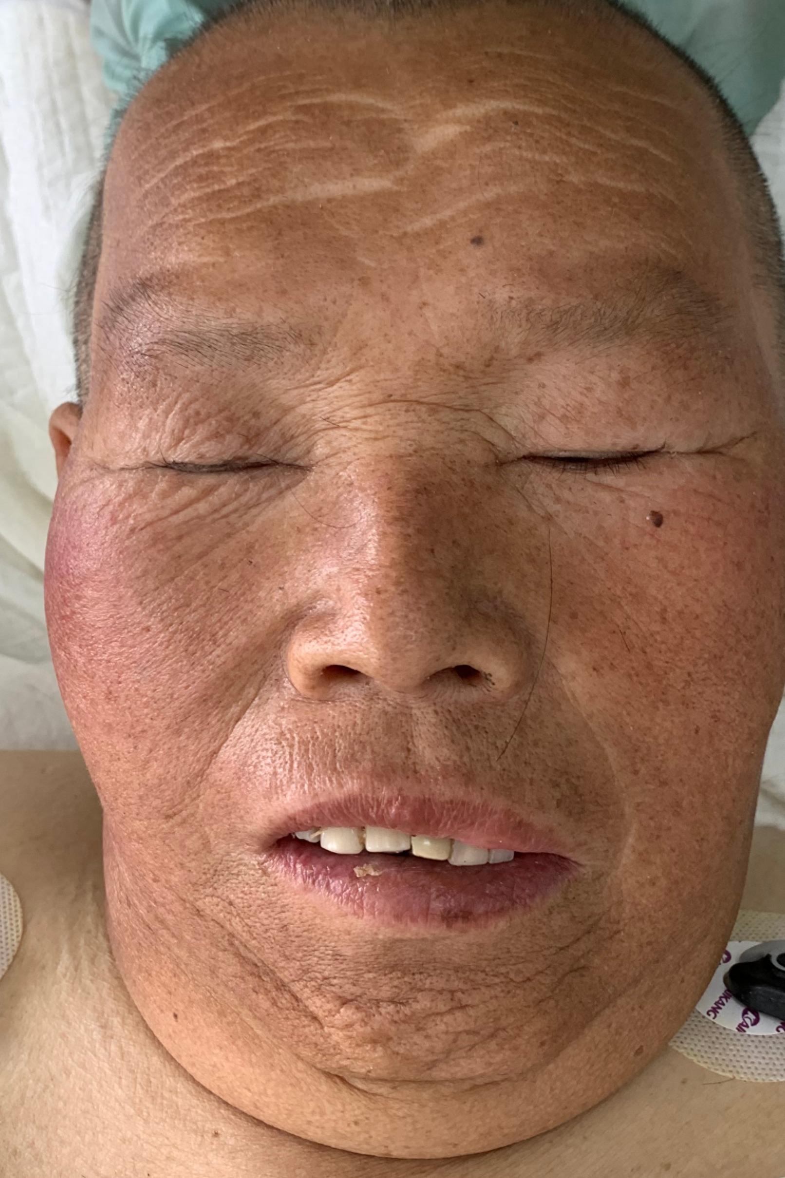 走失者照片 徐州市寻亲：中年男子被救助，自述叫...