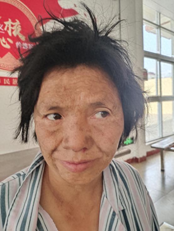 走失者照片 茂名市高州市寻亲：五旬女子被救助，...
