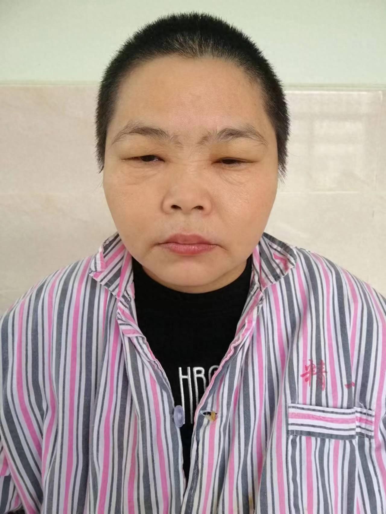 走失者照片 崇左市寻亲：中年女子被救助多年，经...