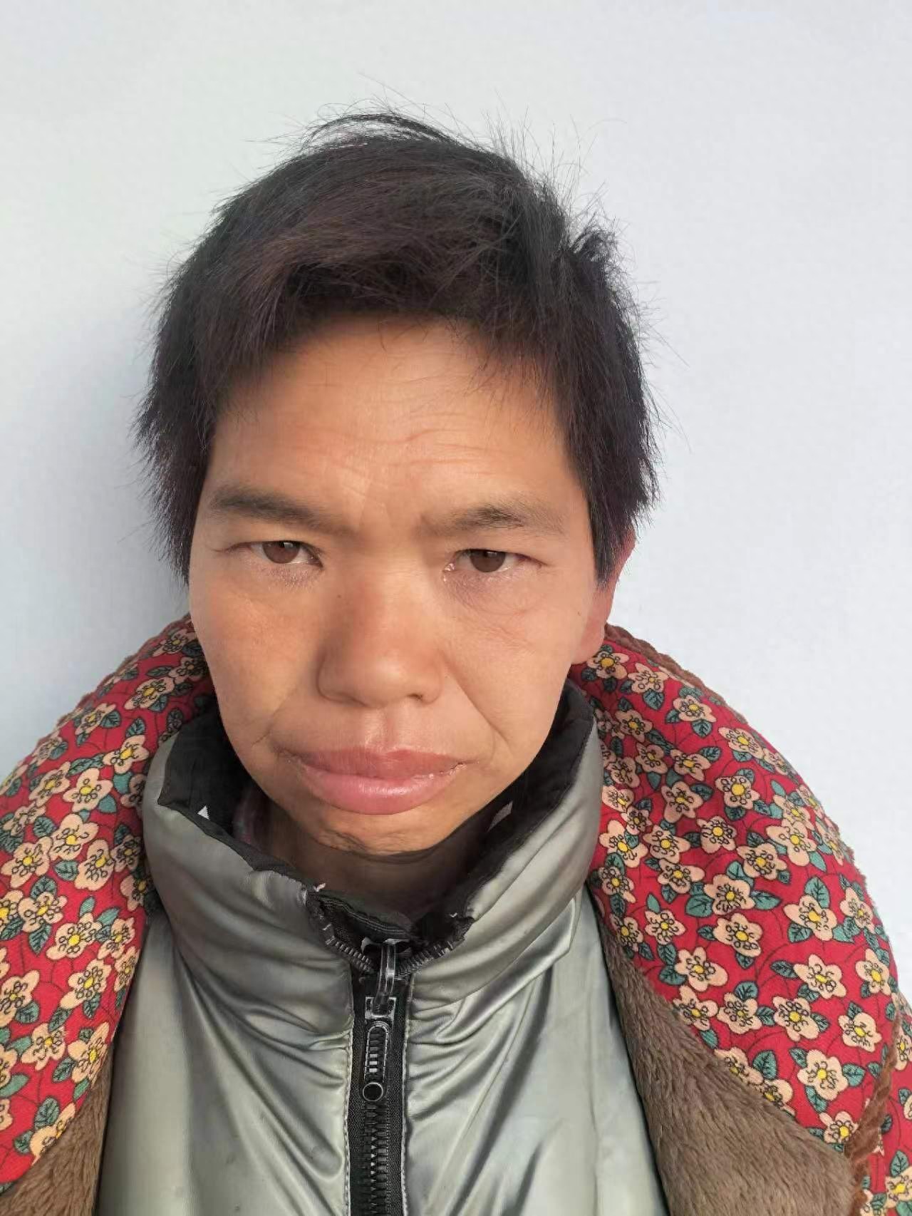 走失者照片 洛阳市寻亲：中年女子被救助，无法正...