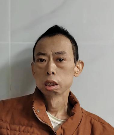 走失者照片 广州市寻亲：中年男子被救助，自述叫...