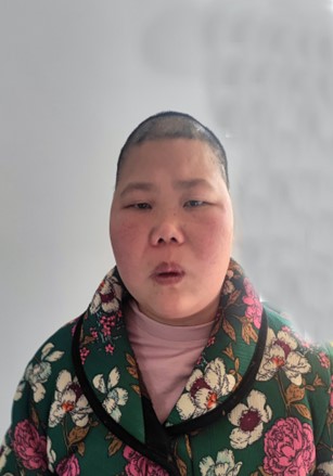 走失者照片 景德镇市寻亲：乐平市青年女子被救助...