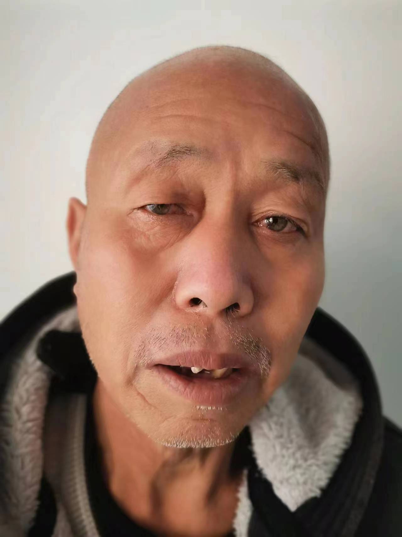 走失者照片 崇左市寻亲：六旬老人被救助，穿迷彩...