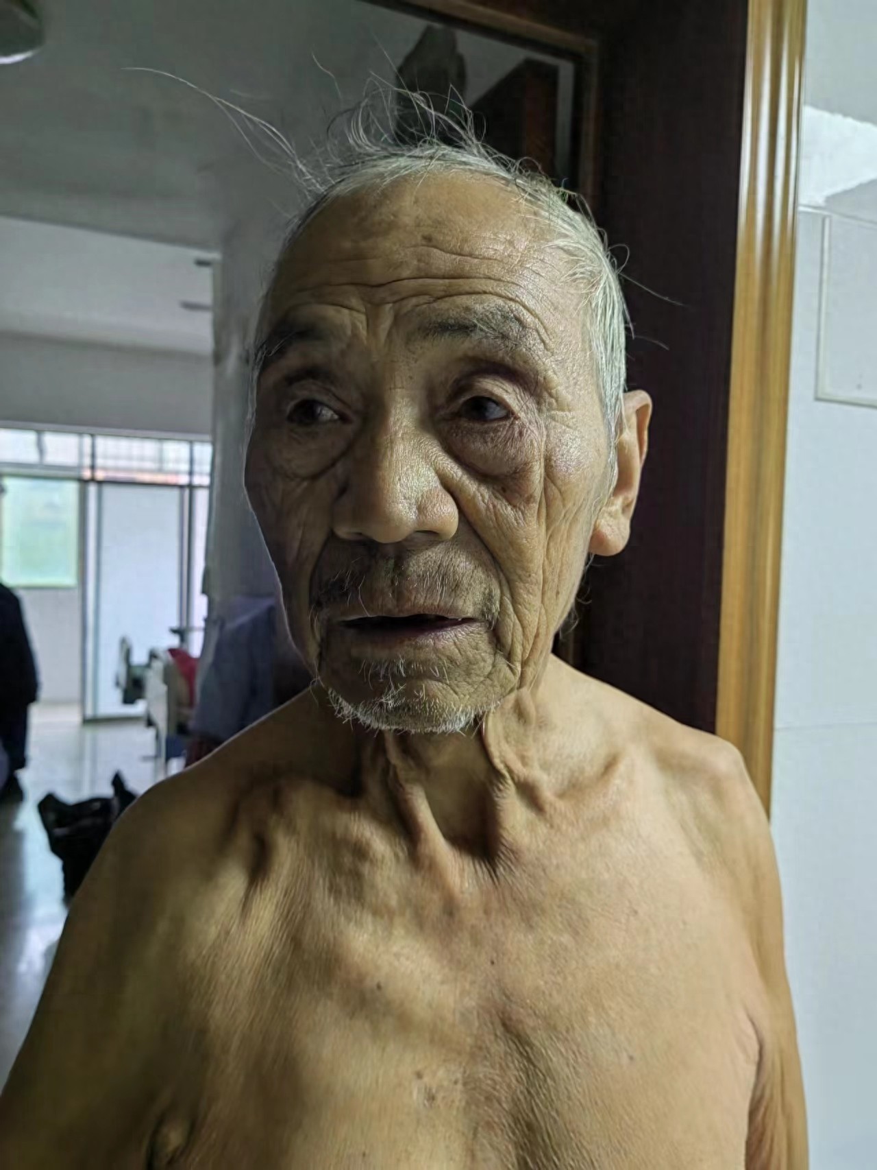 走失者照片 永州市祁阳市寻亲：七旬老人被救助，...