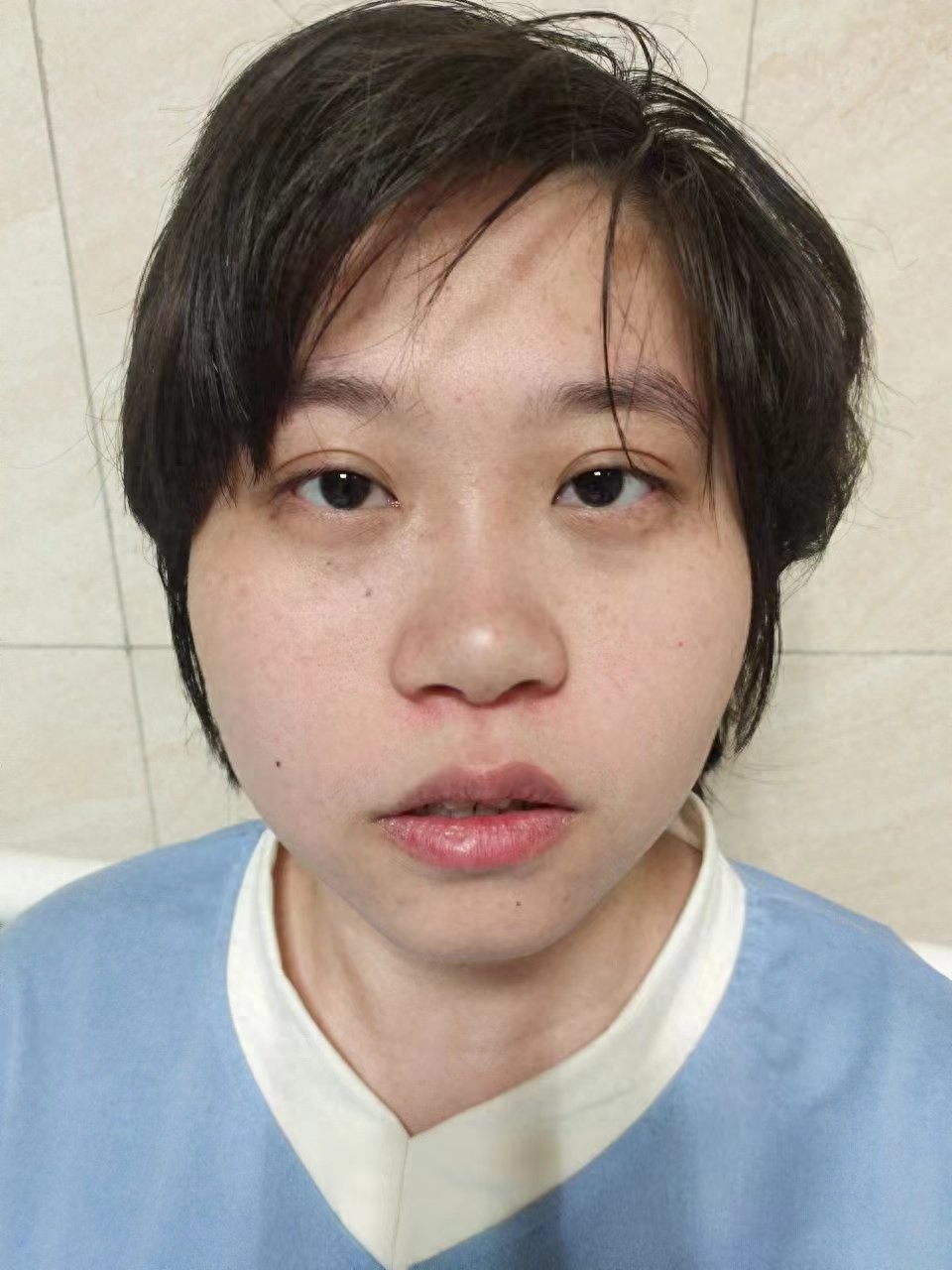 走失者照片 济宁市寻亲：青年女子被救助，穿浅色...