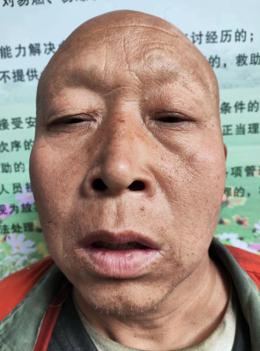 走失者照片 郑州市寻亲：青年男子被救助，自述叫...