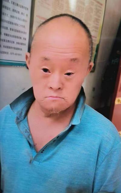 走失者照片 平顶山市急寻：五旬男子走失，患智力...