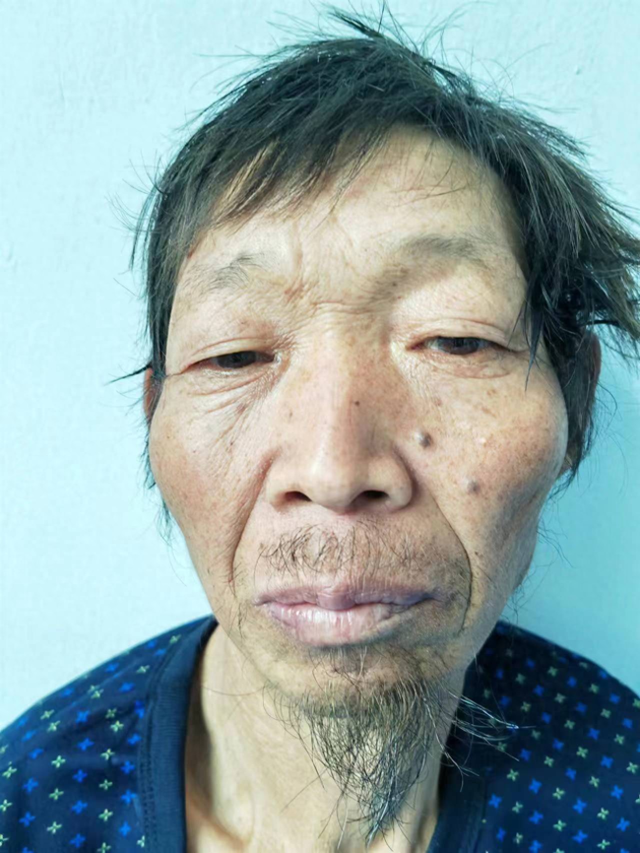 走失者照片 西安市寻亲：五旬男子被救助，自述叫...