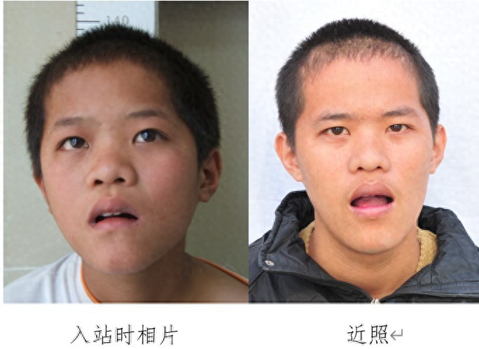 走失者照片 揭阳市寻亲：青年男子在汕头被救助，...